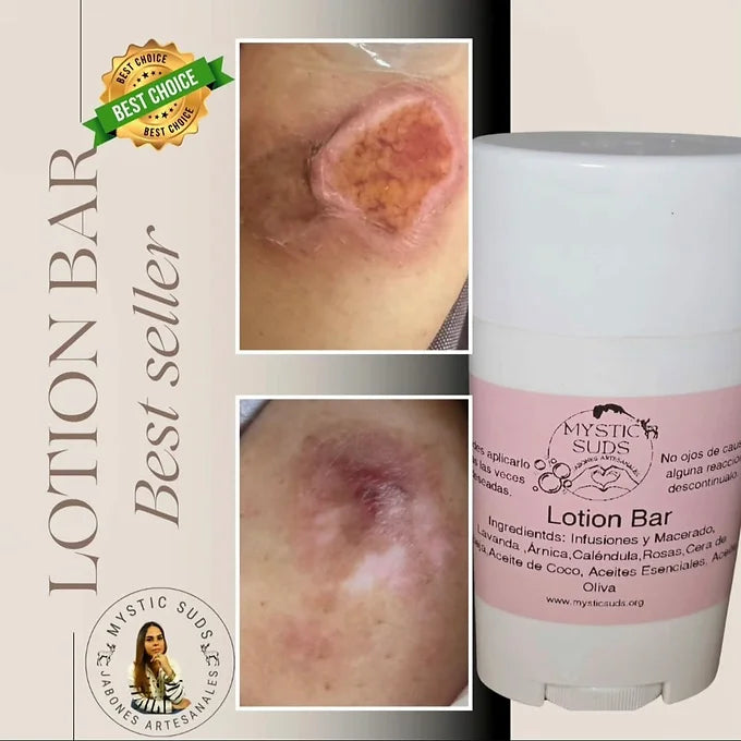 Lotion Bar - Tratamiento Natural para Condiciones de la Piel