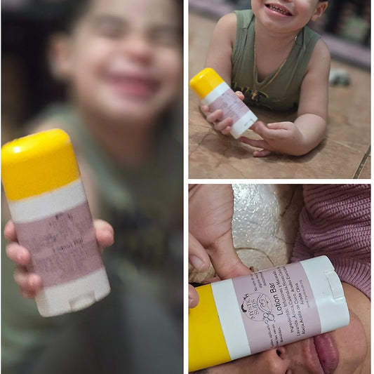 Lotion Bar - Tratamiento Natural para Condiciones de la Piel