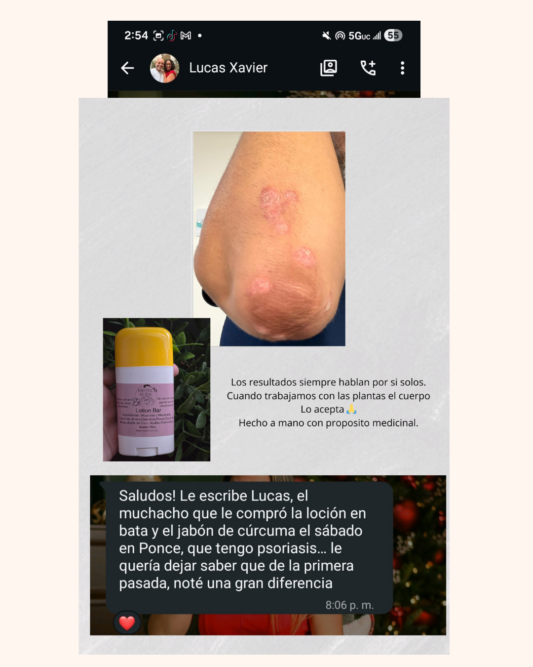 Lotion Bar - Tratamiento Natural para Condiciones de la Piel