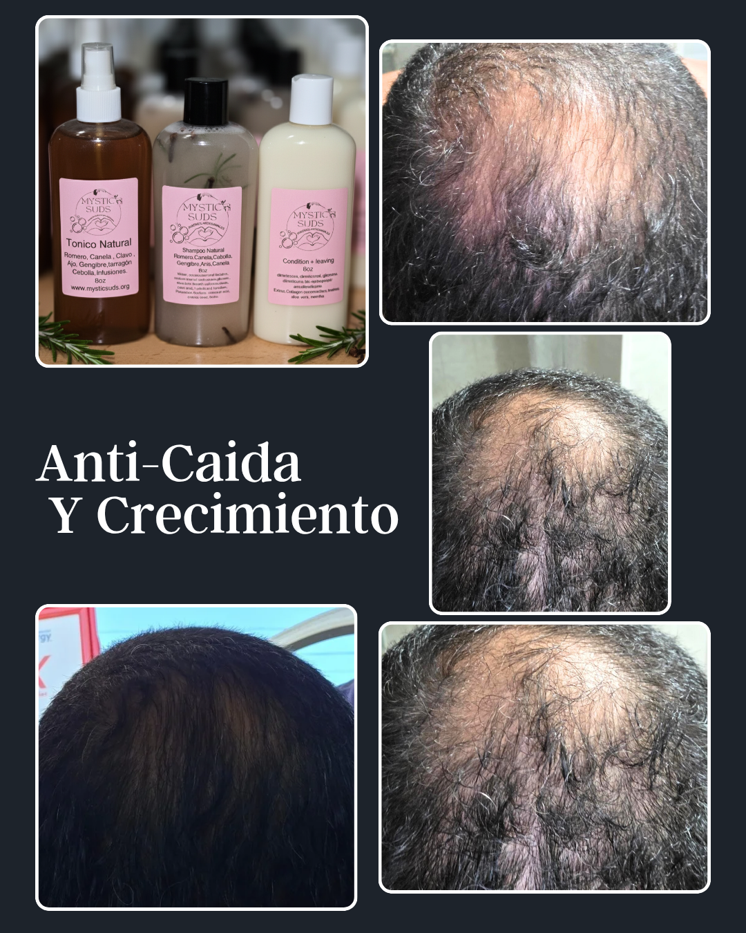 Shampoo Solido
