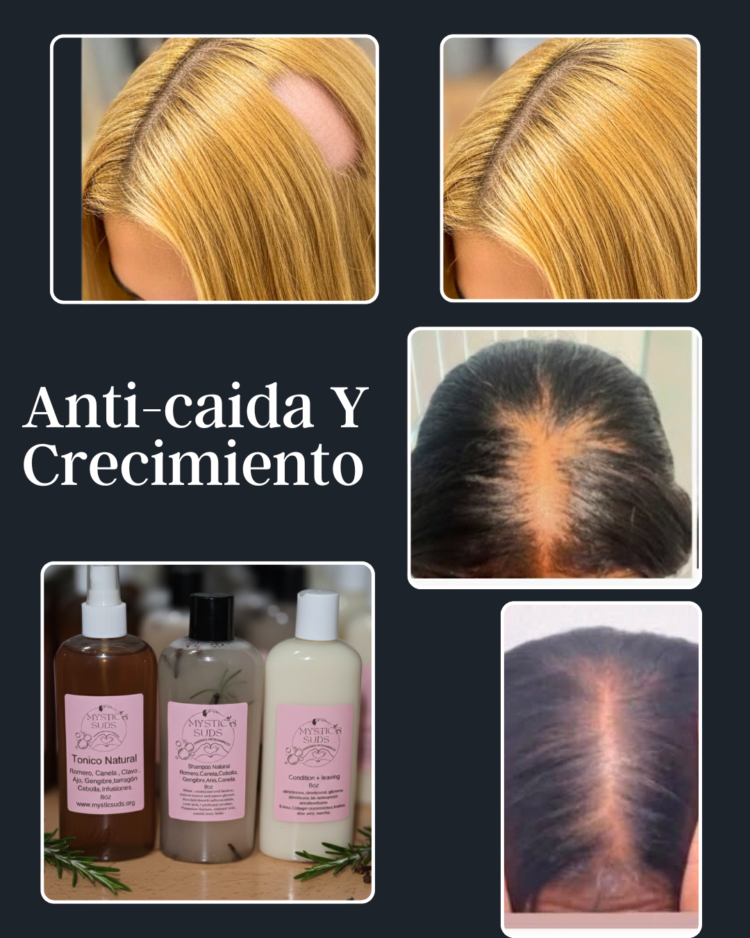 Shampoo Solido
