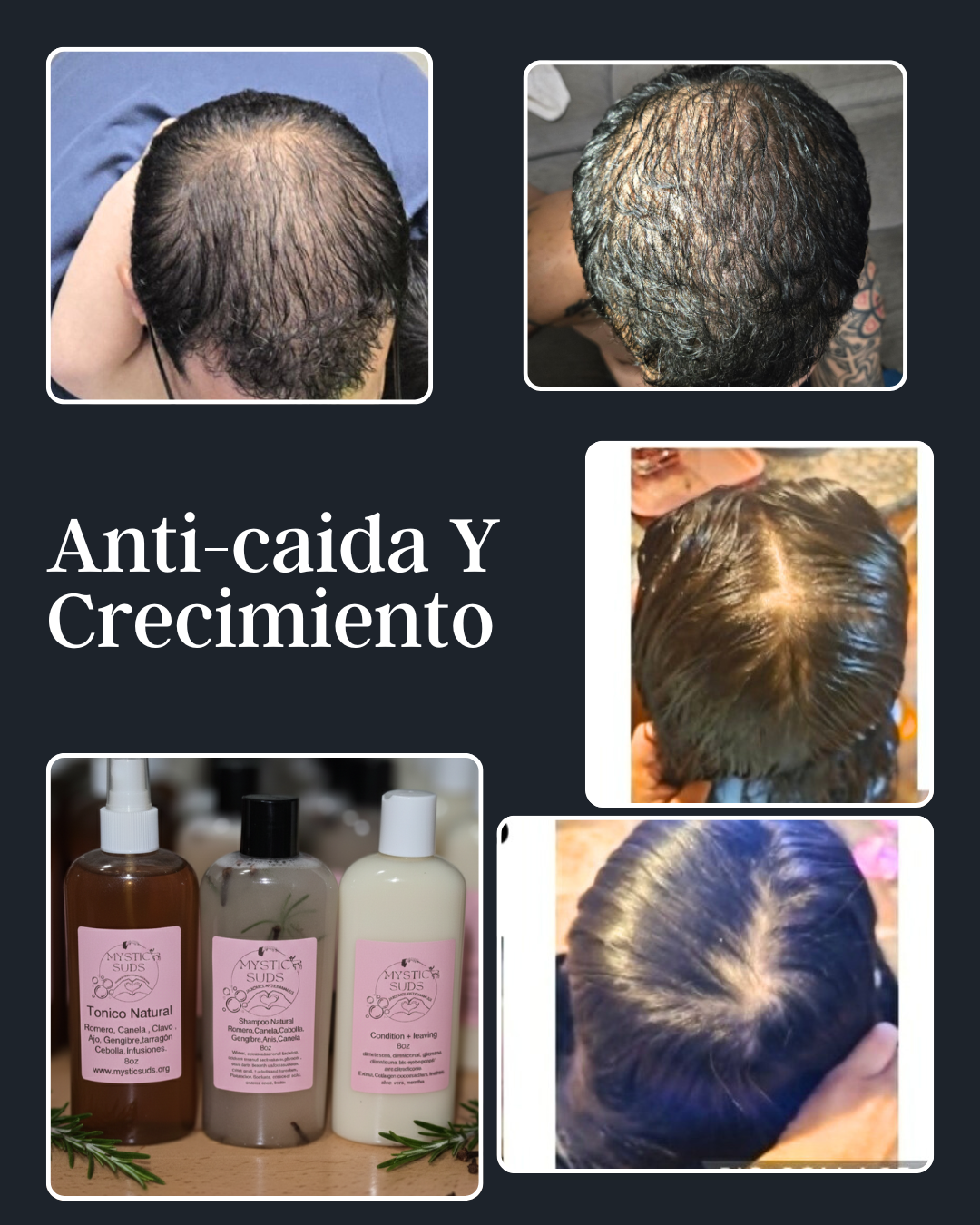 Shampoo Solido